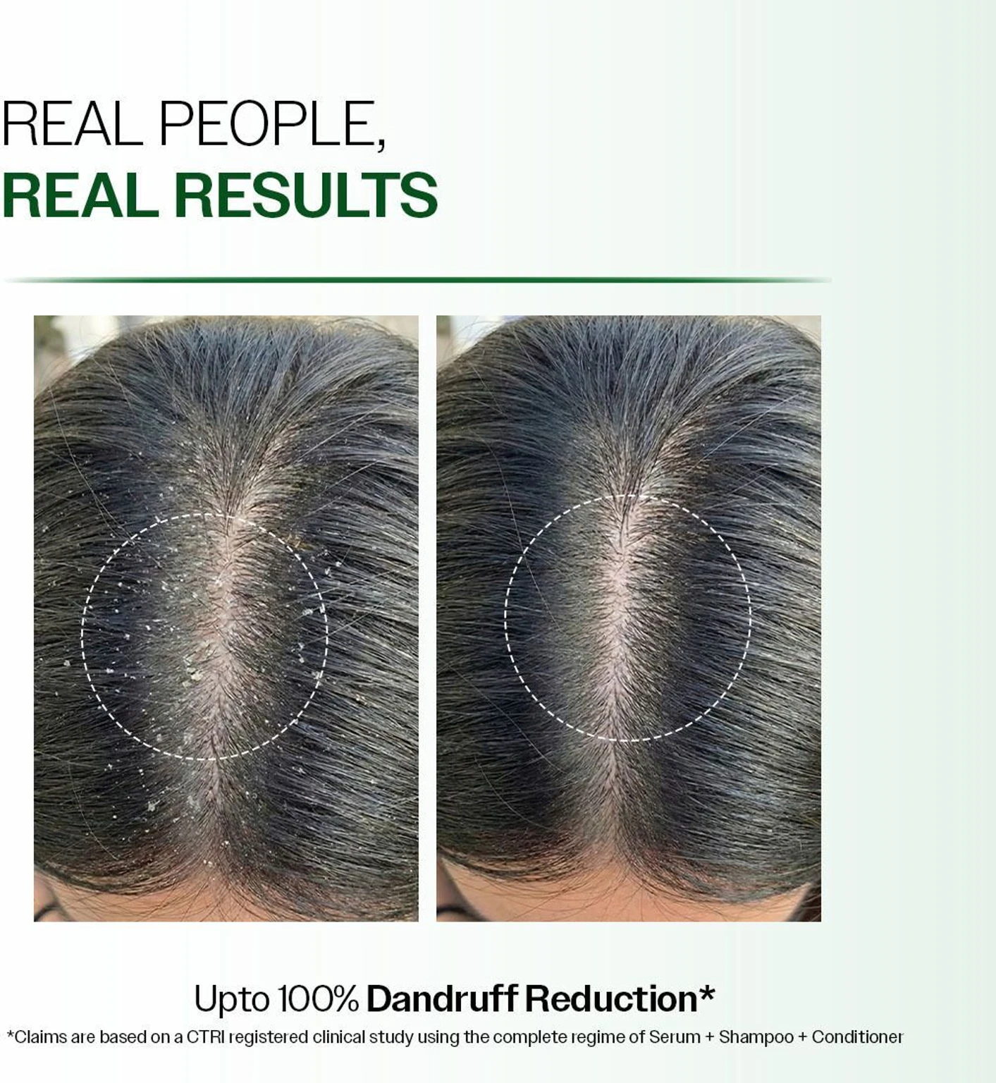 Anti Dandruff Hair Repair Serum - Image 4